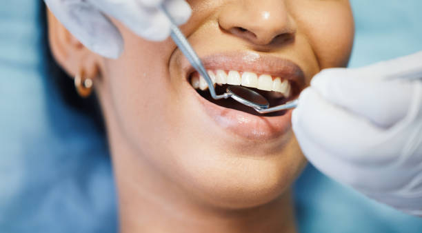 Best After-Hours Emergency Dentist in Mount Sterling, OH