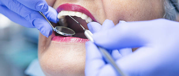 Best Emergency Treatment for Toothache in Mount Sterling, OH